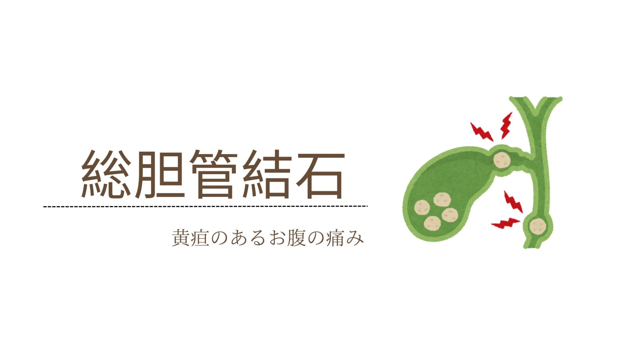 総胆管結石とは? | みどりのふきたクリニック
