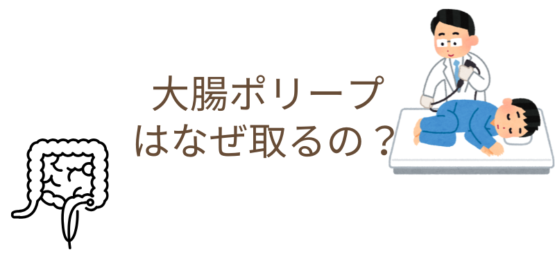 大腸ポリープはなぜ取るの？大腸ポリープ切除を行う理由について